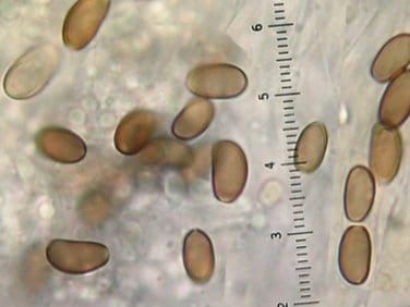 Studying Spores Using A Microscope