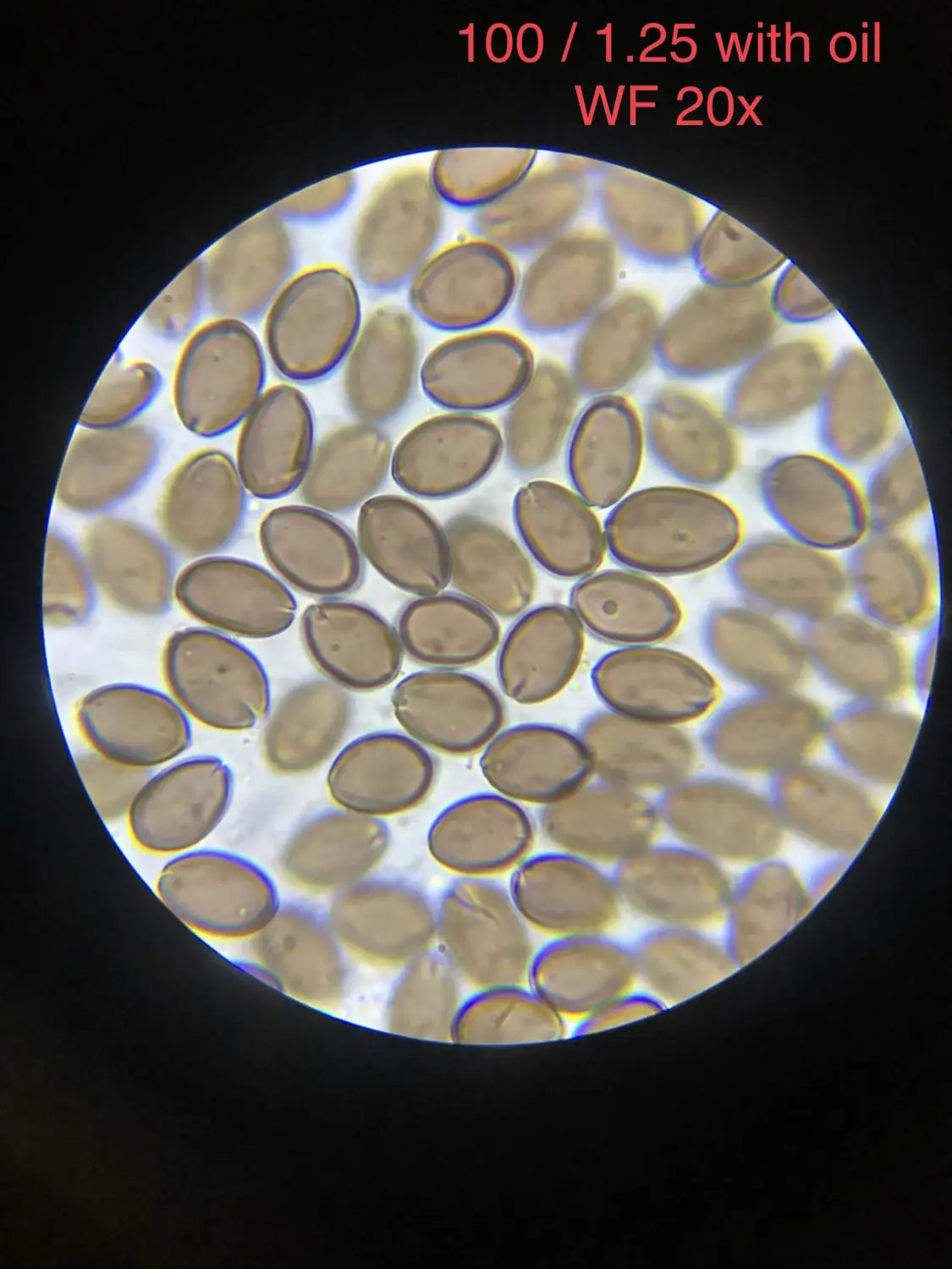 Studying Spores Using A Microscope